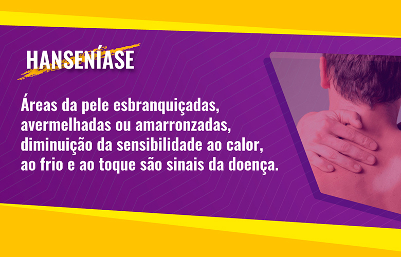 Créditos: Ministério da Saúde Créditos: Ministério da Saúde