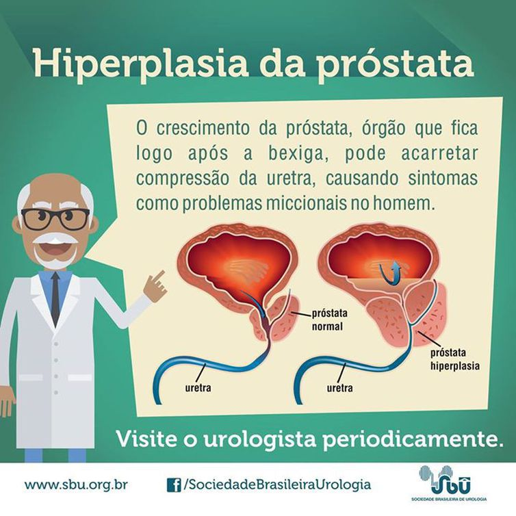 Próstata
