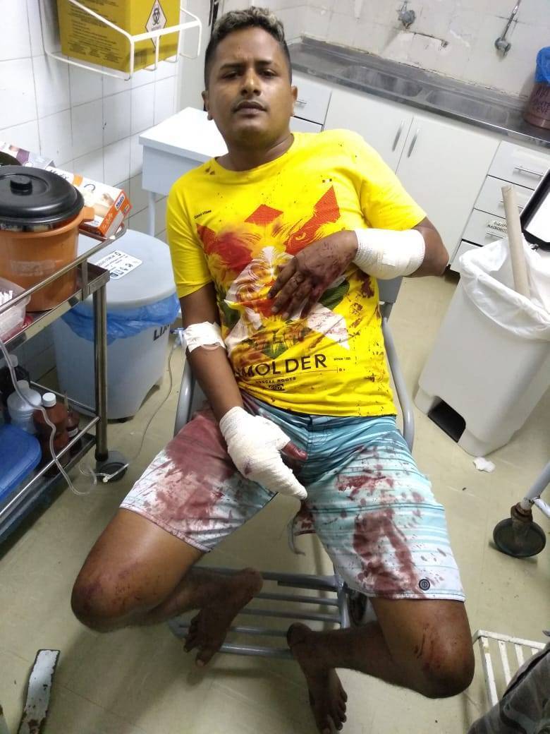 baleado_e414713732aba596aa052a0bc0169394ba16126c.jpg