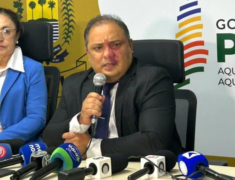 O caso foi detalhado por delegado-geral da PC-PI Luccy Keiko durante coletiva de imprensa nesta segunda-feira (23).