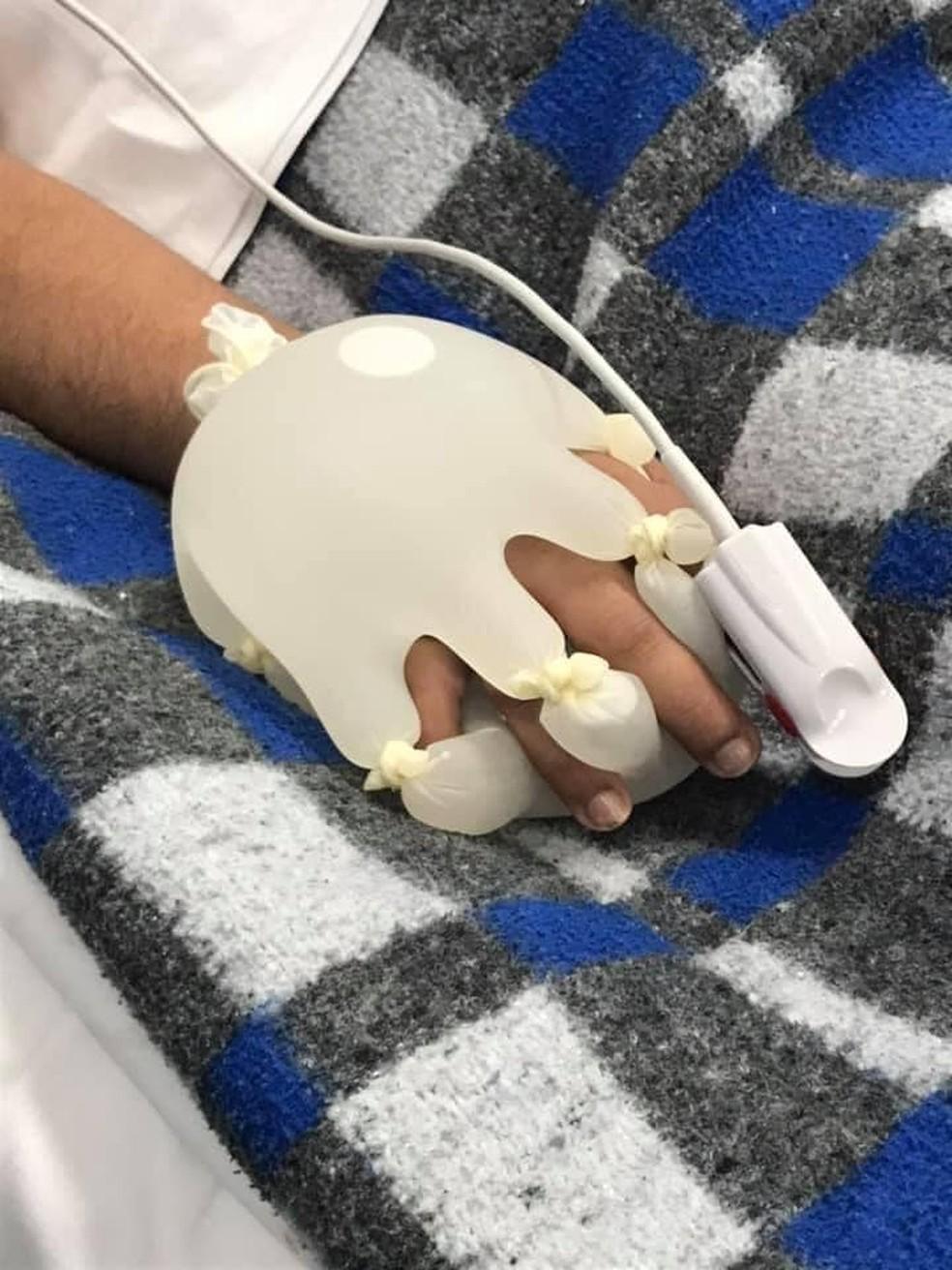 Ténica da mãozinha ou 'mão de Deus': conforto físico e psicológico para quem está na UTI