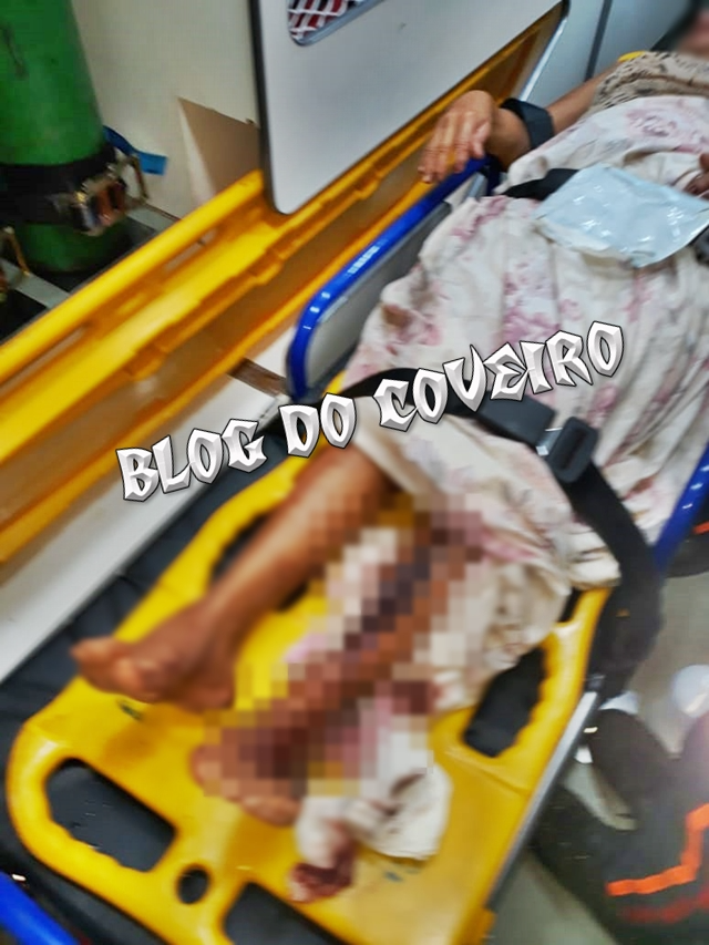 Idosa atingida na perna