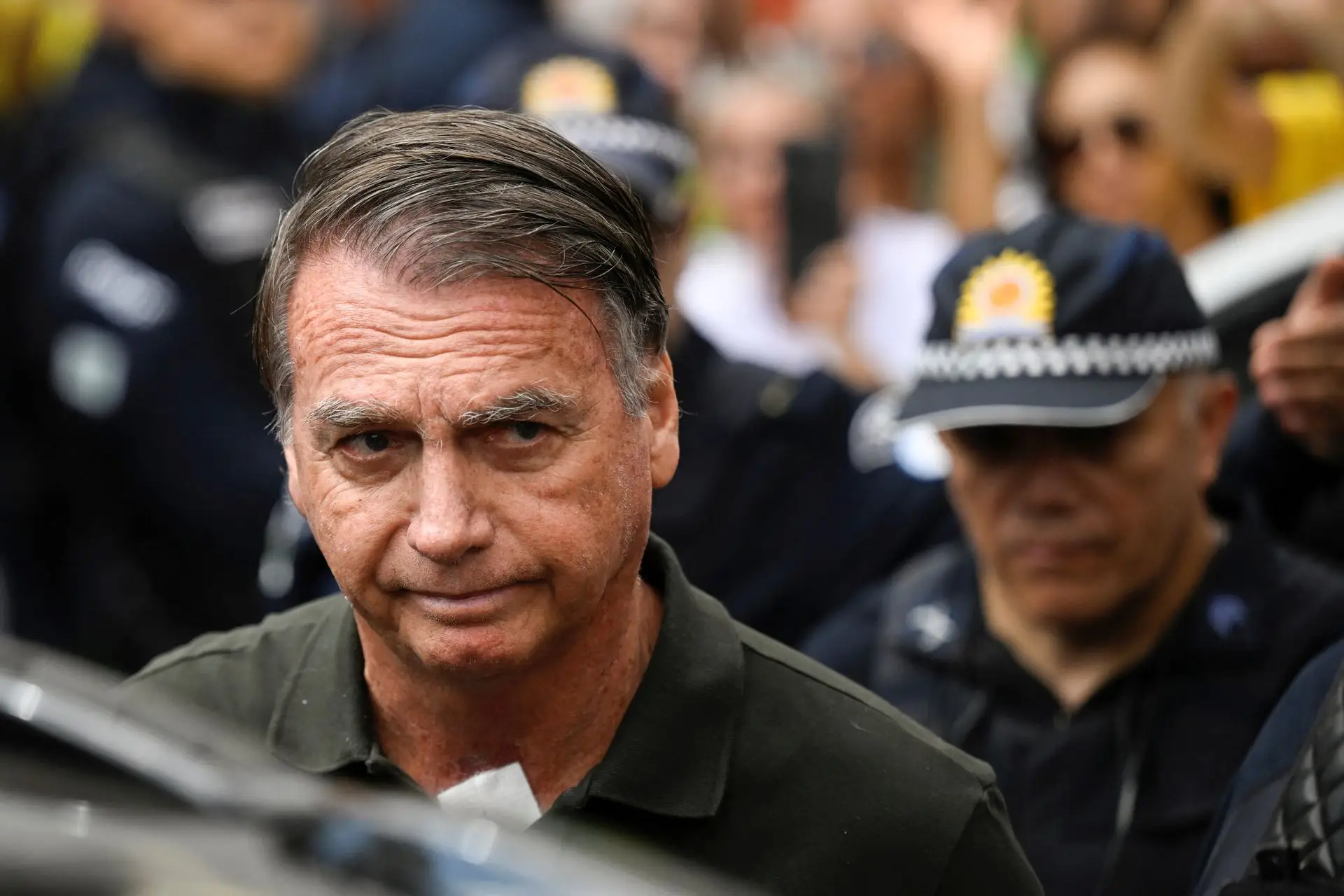 Bolsonaro fará uma cirurgia eletiva, ou seja, não é de urgência, mas é importante para evitar agravamento