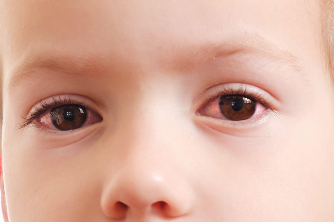Doença nos olhos