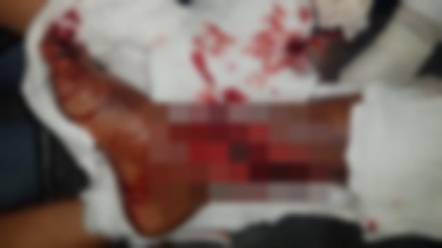 A vítima ficou com a perna bastante ferida