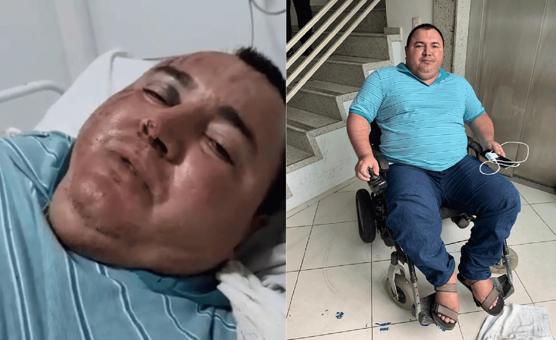 Wilson ficou bastante machucado e terá que passar por uma cirurgia
