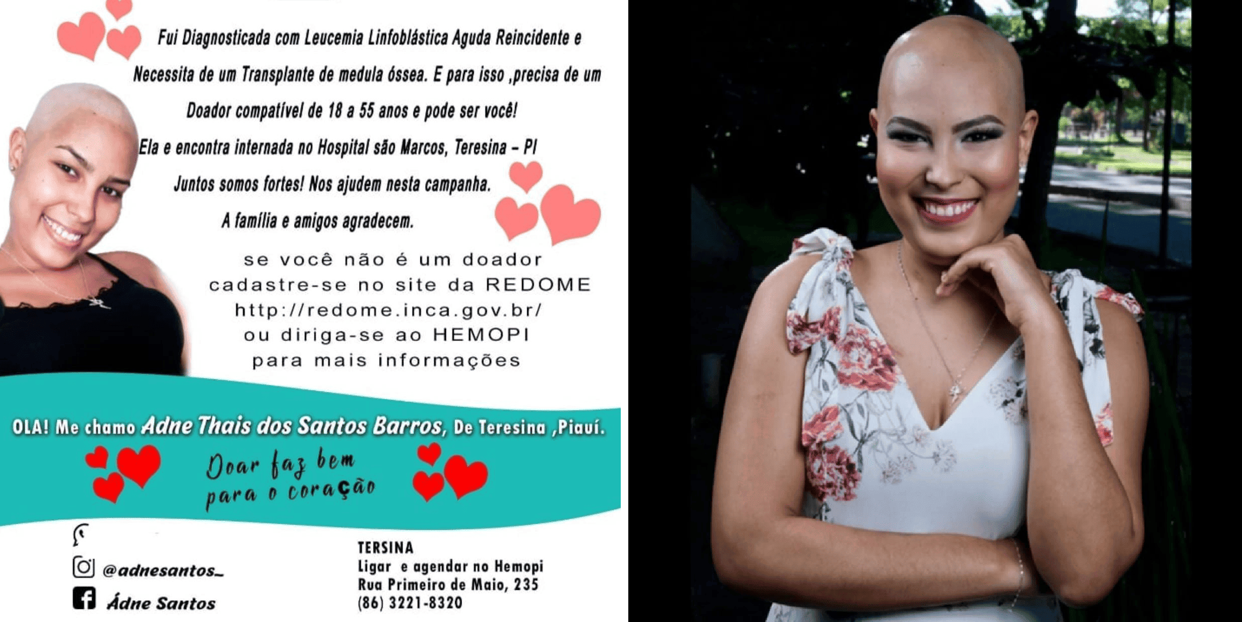 Adne luta contra a leucemia e precisa de transplante de medula osséa