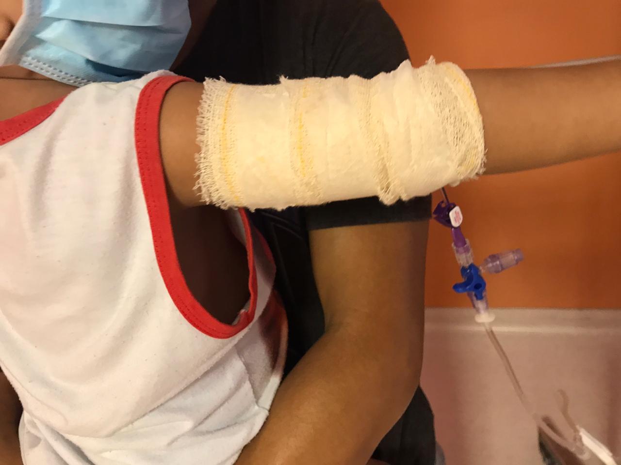 Criança usando o PICC