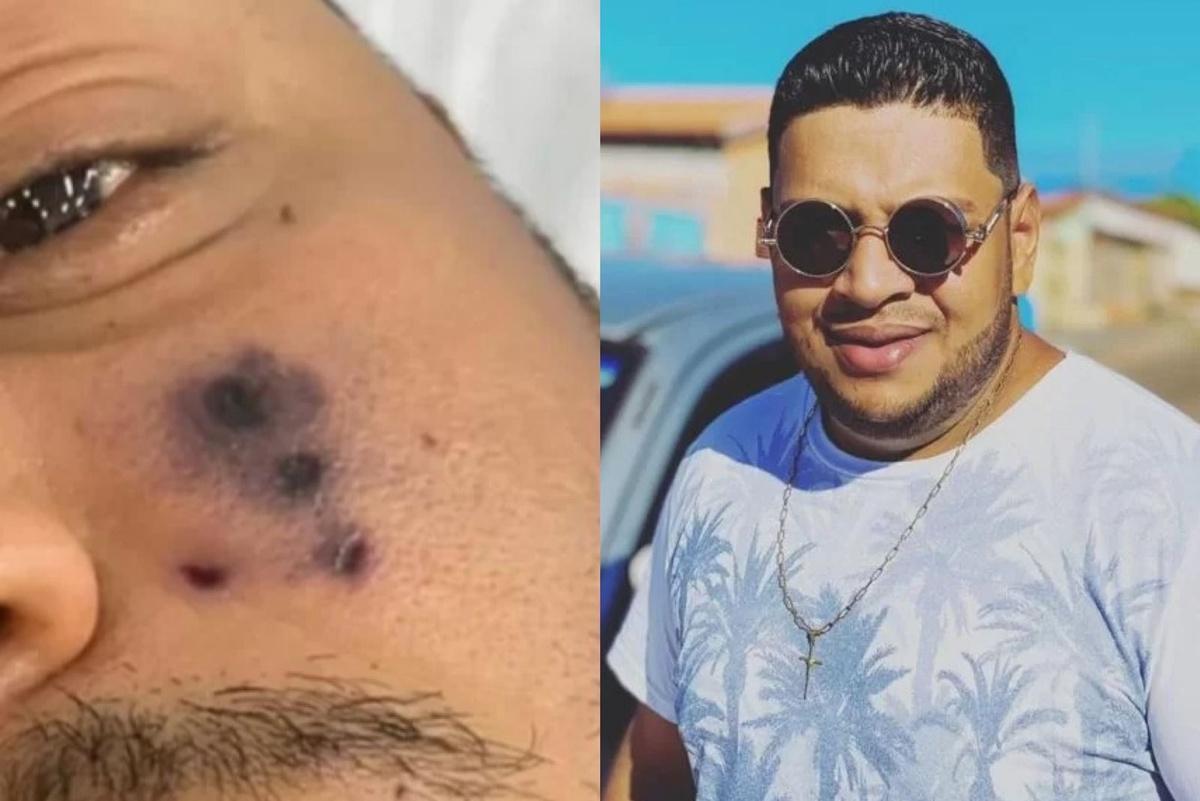 Cantor chegou a ser internado em um hospital local