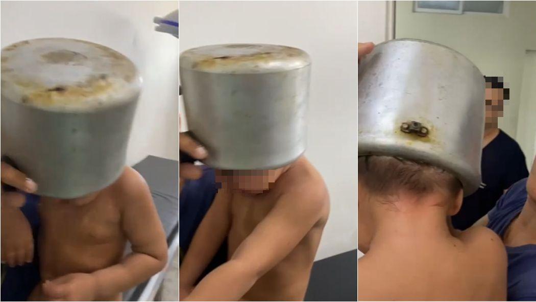 Criança prendeu a cabeça em panela de pressão