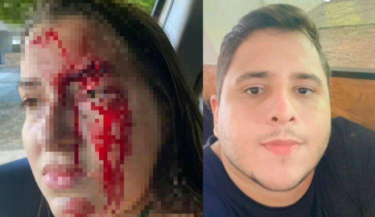 Estudante acusa o namorado de agressão