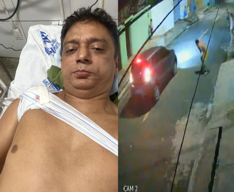 Homem é baleado no ombro após tentar defender irmão de agressão na Zona Sul de Teresina; caso foi registrado por câmeras de segurança.