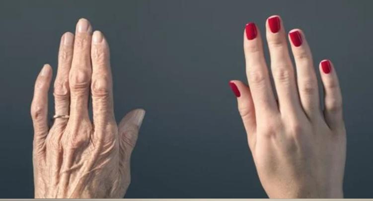 Rejuvenescimento