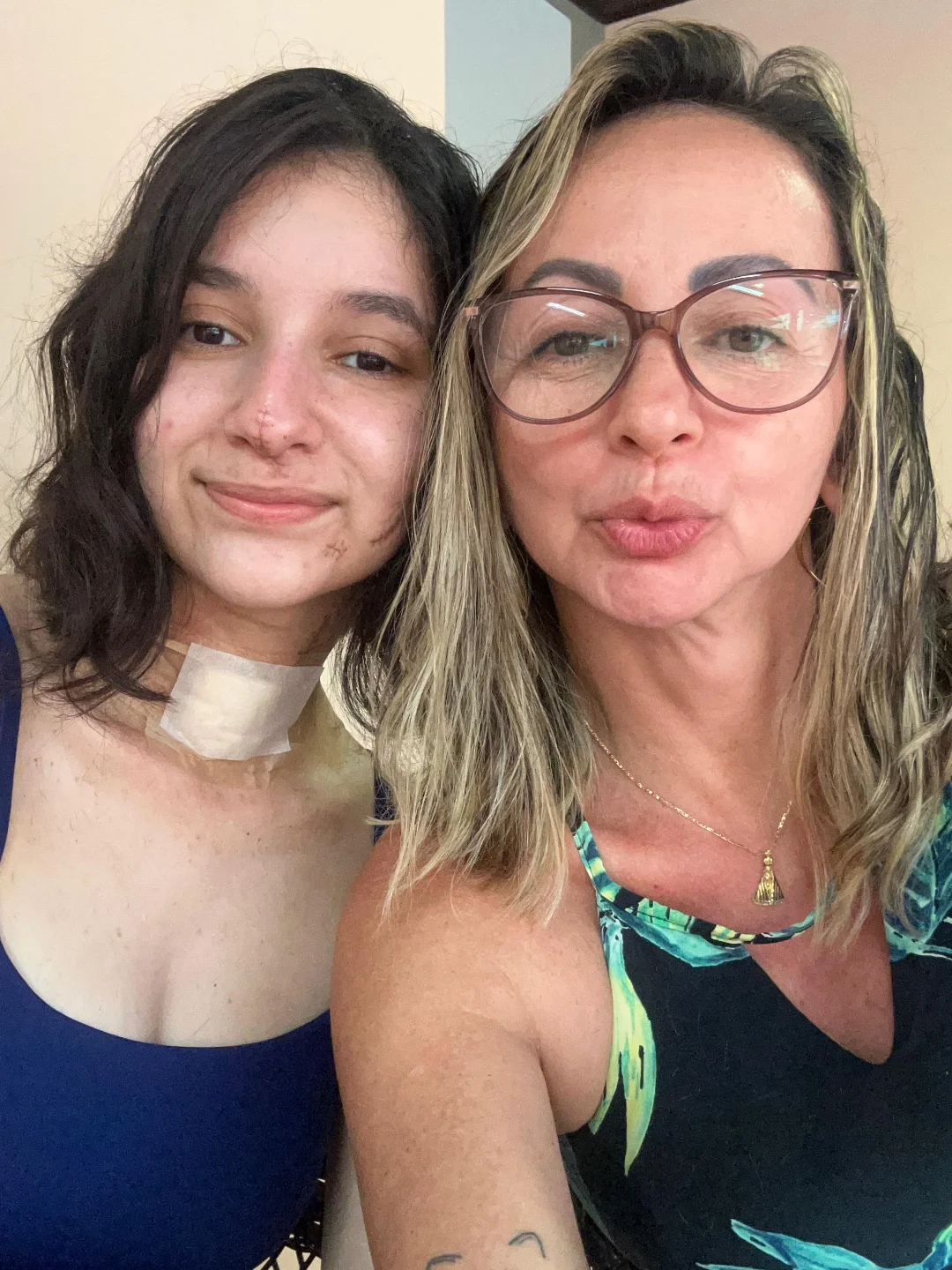 Após sobreviver a ataque a facadas, jovem aparece com a mãe nas redes sociais e inicia nova fase durante recuperação