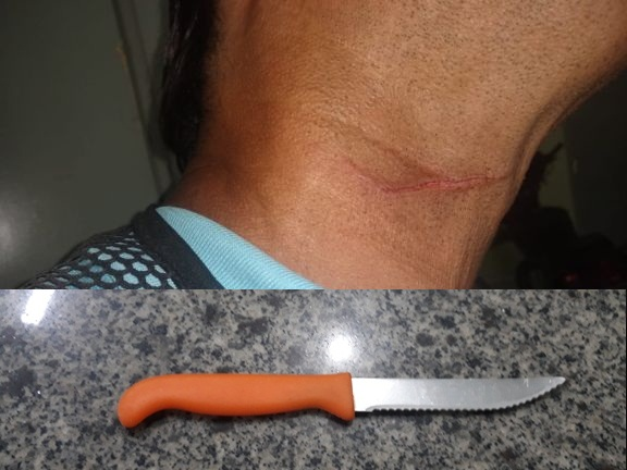 Assalto com agressão física