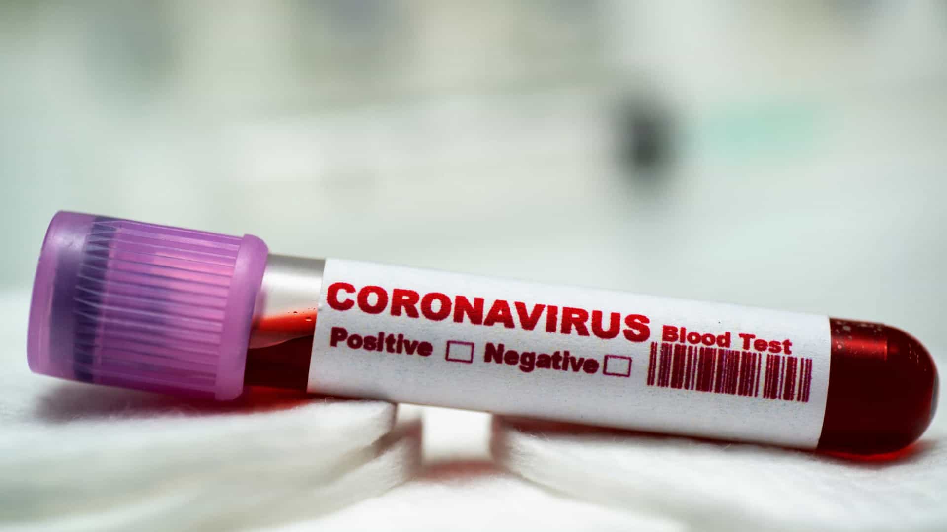 EUA têm o primeiro caso confirmado de reinfecção de Covid-19