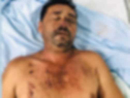 Criminoso dá nome falso em hospital do Piauí após sofrer acidente