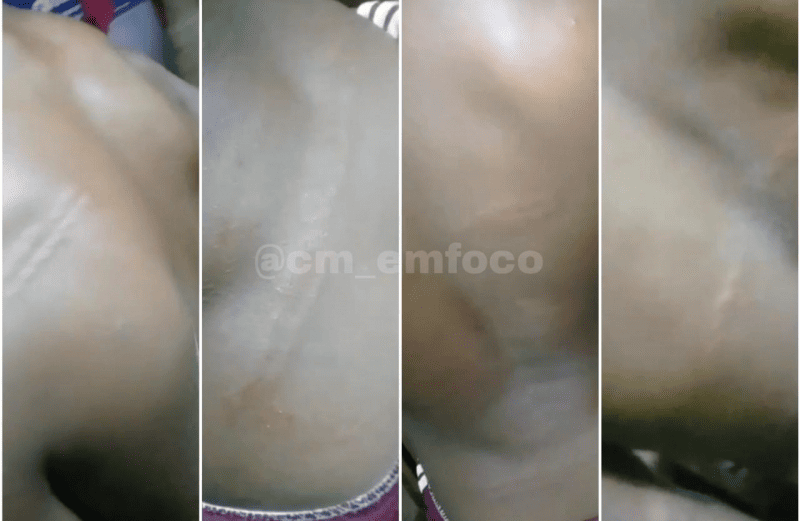 Adolescente é agredido
