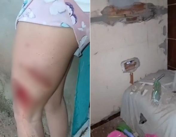 Jovem sofre queimaduras na perna ao ser atingida por raio dentro de casa