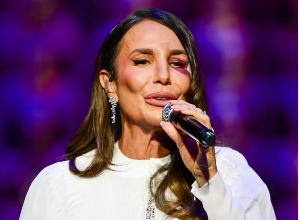 Ivete Sangalo preferiu mostrar o olho roxo aos fãs