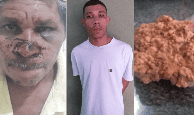 Jovem é preso após agredir homem a pedradas