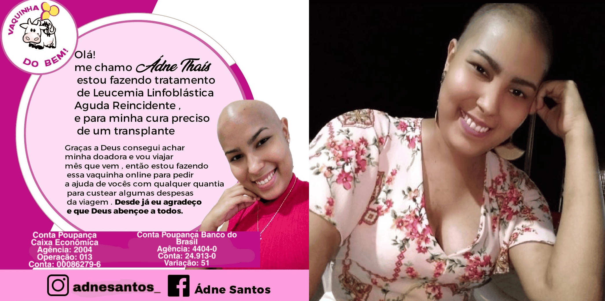 Adne Santos