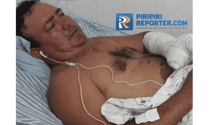 Foguete explode na mão de vereador em Piripiri