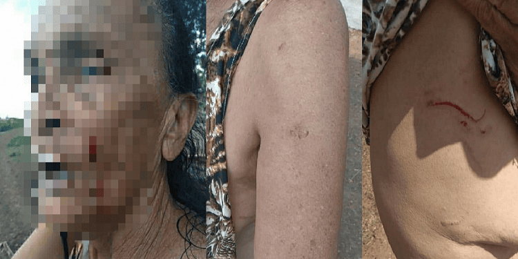 Idosa denuncia que foi agredida por duas mulheres