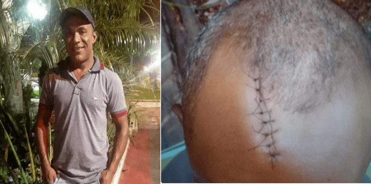 Homem morre após receber facada na cabeça