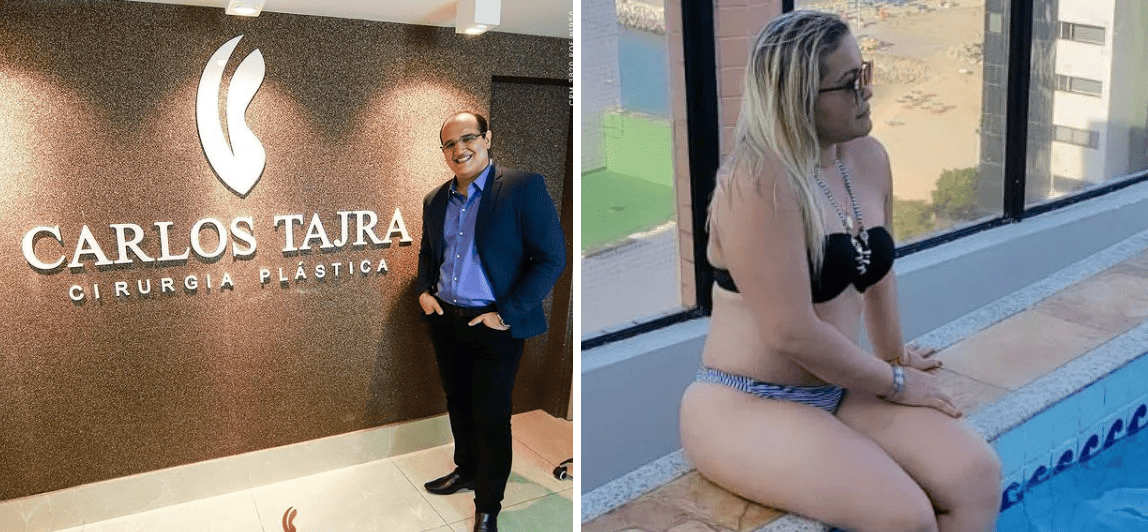 Mulher morre após cirurgia plástica e cirurgião se pronuncia