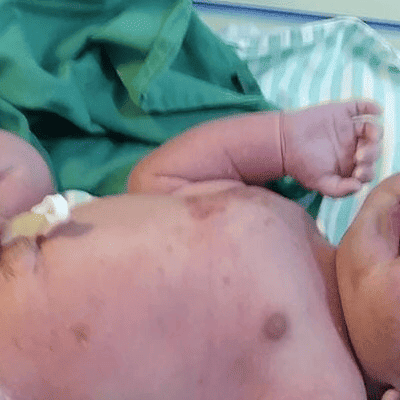 Bebê nasceu bem e saudável