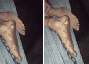 Criança autista é mantida presa em corrente dentro de casa no Norte do Piauí