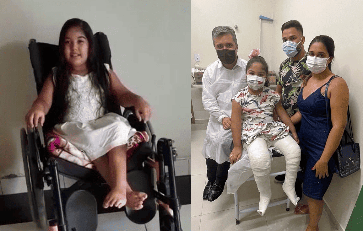 Maria Paulina fez a cirurgia para correção do pé torto congênito