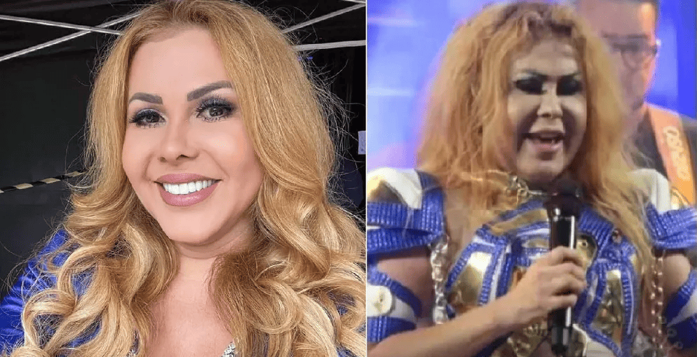 Joelma passa por exames para tratar das sequelas da Covid