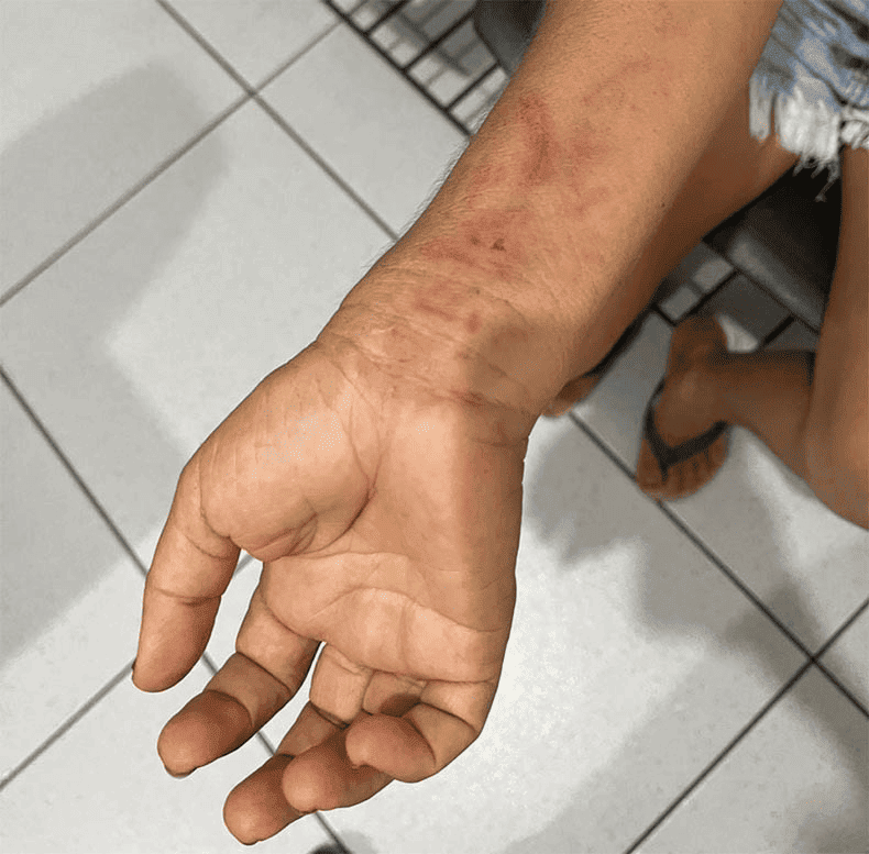 Mulher é mantida em cárcere privado por oito meses no Piauí