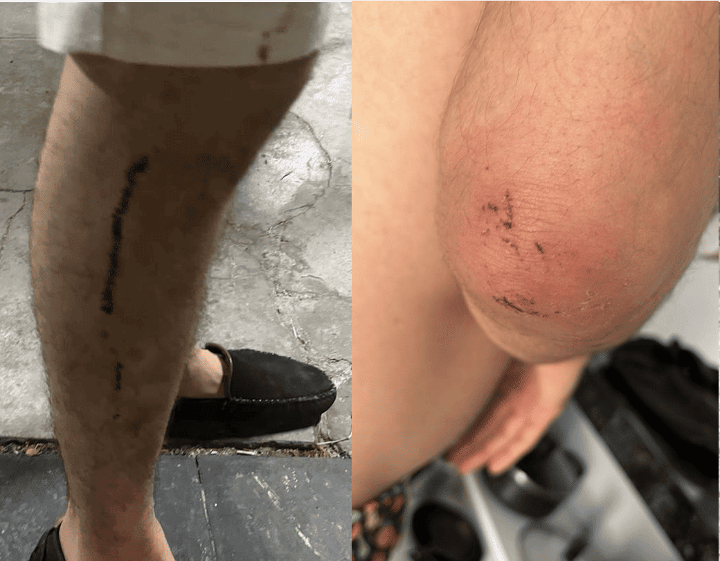 A vítima teve escoriações leves pelo corpo