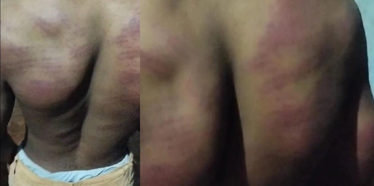 O jovem relatou que foi torturado com cacete e mangueira
