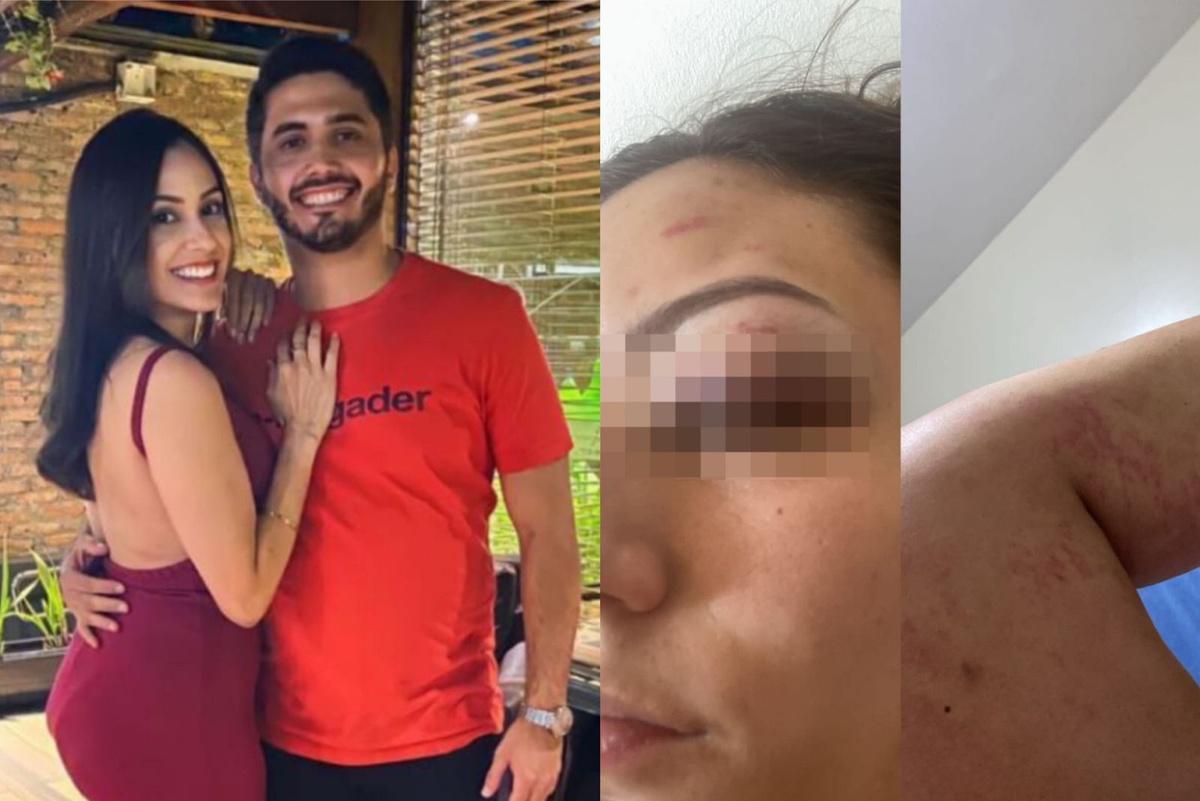Karlene acusa o ex-namorado de agressão