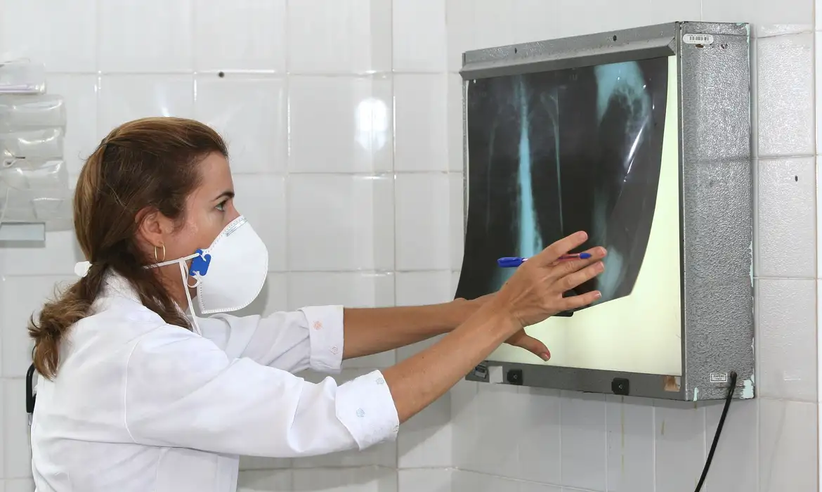 O principal sintoma da tuberculose pulmonar é a tosse